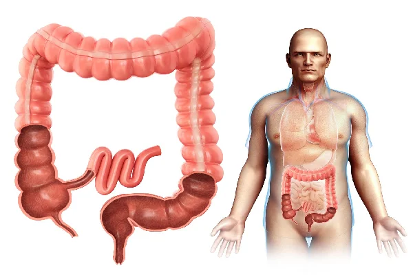 Large Intestine and Colon Diseases