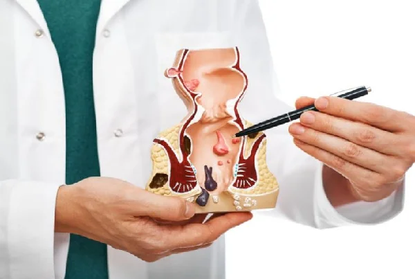 Anus and Rectum Diseases