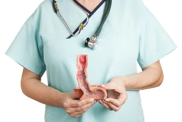 Esophagus Surgery