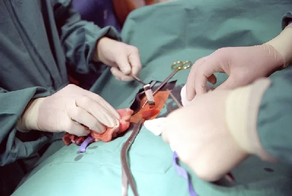 Pancreas Surgery