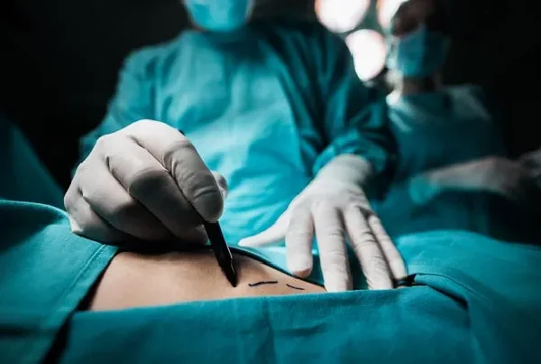 Miscellaneous Surgery